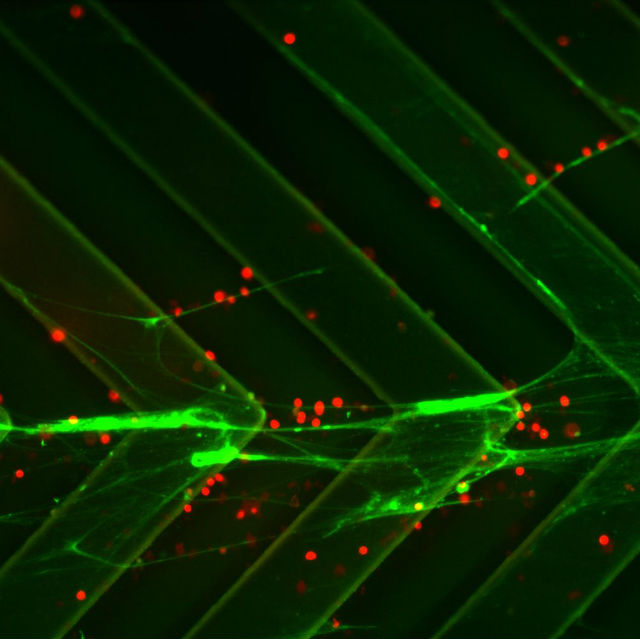 Клетки (красные), проходящие по микрофлюидному каналу могут быть захвалены нитями ДНК (зелёные) (фото Suman Bose, Chong Shen).