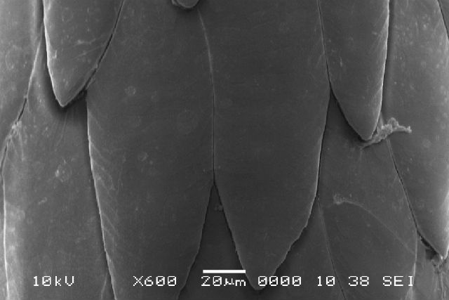 Зубцы на иглах дикобраза под микроскопом (иллюстрация Jeffrey Karp, Harvard Medical School).