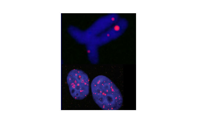 Учёные проявили наличие четырёхниточной ДНК в клетках при помощи флуоресцентных маркеров (фото Jean-Paul Rodriguez, Giulia Biffi).