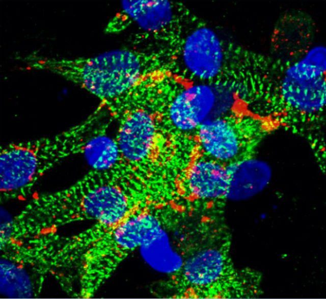 Так выглядит "конструкция" из живых клеток и углеродных нанотрубок под микроскопом. Для пущей наглядности учёные подсветили отдельные элементы флуорецирующими белками (фото Mehmet Dokmeci).