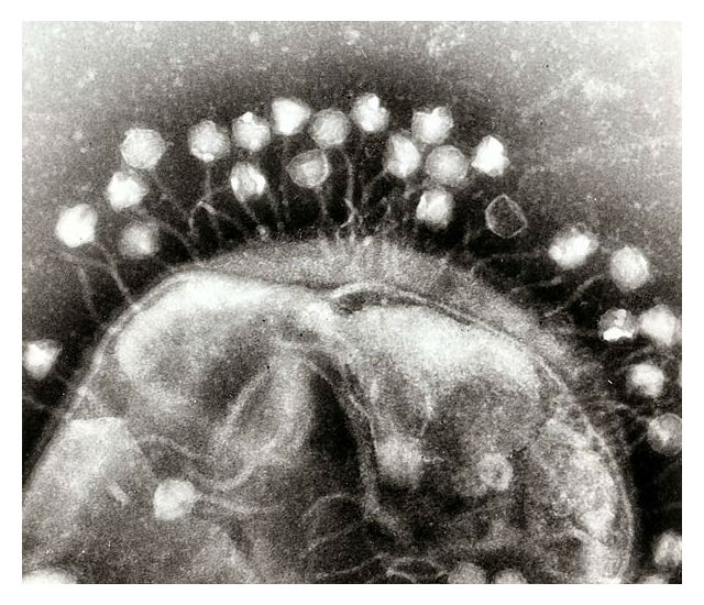 Бактериофаги, оккупировавшие поверхность бактериальной клетки (фото Dr Graham Beards/Wikimedia Commons).