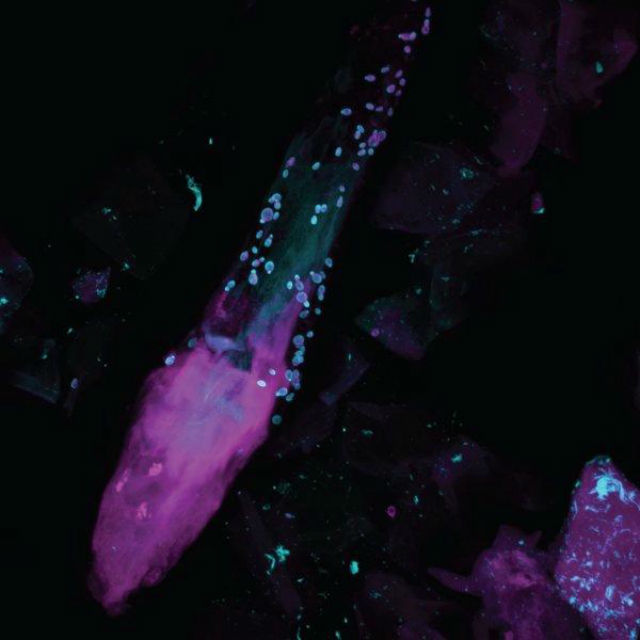 Волосяной фолликул со спины добровольца, снятый флуоресцентным микроскопом. Голубым цветом светятся грибки, розовым — бактерии (фото Alex Valm/NHGR). 