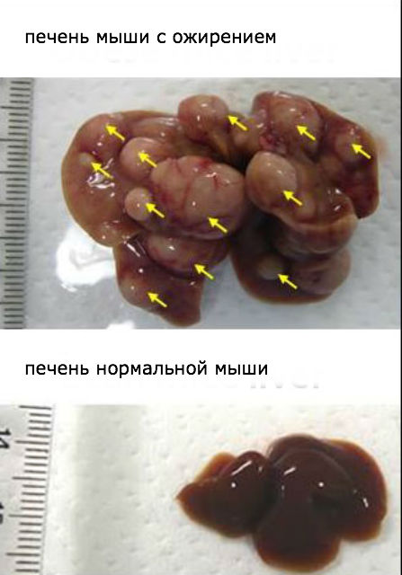 Вверху изображена печень ожиревшей мыши, а внизу — нормальной (фото Eiji Hara/Japanese Foundation for Cancer Research). 