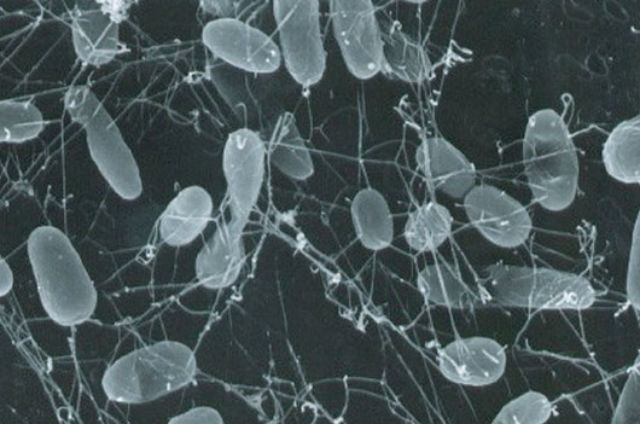 Лучше всего в далёком будущем Земли жить будет бактериям-термофилам, которые смогут выдержать высокие температуры и радиацию (фото Mark Amend/NOAA Photo Library). 