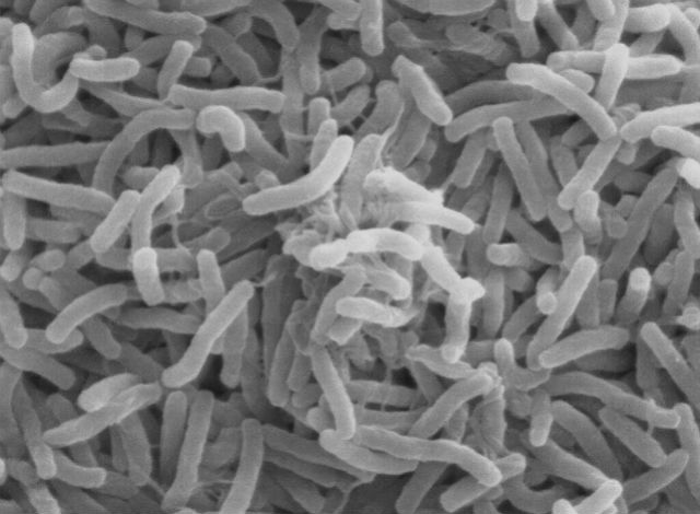 Электронная микрофотография холерных вибрионов — возбудителей инфекции (фото T.J. Kirn, M.J. Lafferty, C.M.P Sandoe, R.K. Taylor/Wikimedia Commons). 