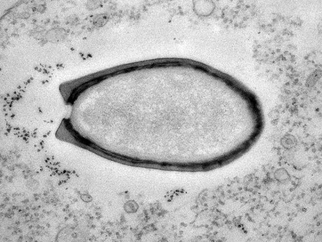 Пандоравирус под электронным микроскопом (фото Chantal Abergel and Jean-Michel Claverie). 