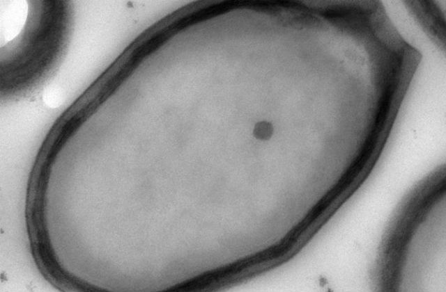 Увеличенный снимок гигантского вируса (фото Chantal Abergel and Jean-Michel Claverie). 