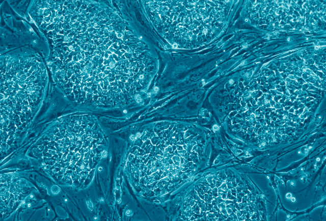 Так выглядят человеческие стволовые клетки под микроскопом (фото Nissim Benvenisty/Wikimedia Commons). 