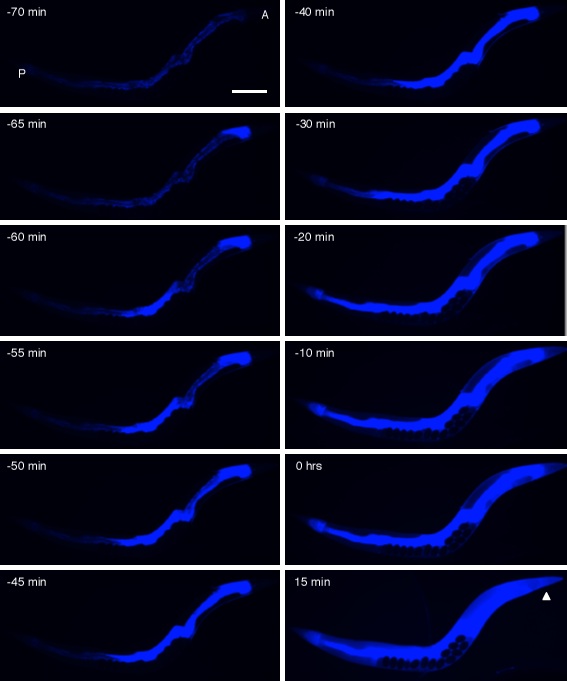 Клеточные изменения в момент смерти нематоды – синяя флуоресценция отмечает разрушенные клетки. Изображения сделаны с интервалами в 5, 10 и 15 минут (фото David Gems/PLoS Biology).