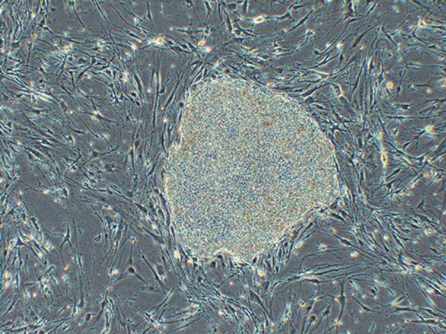 Человеческая индуцированная плюрипотентная стволовая клетка (фото RIKEN). 