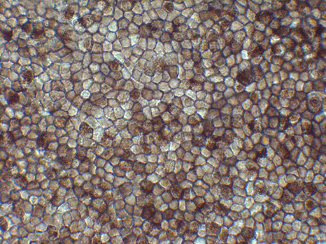 Пигментный эпителий сетчатки человека (фото RIKEN). 