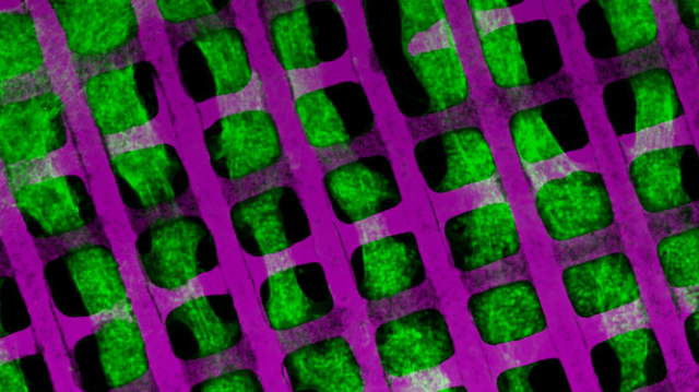 Мышечная матрица. Этот снимок, сделанный с помощью конфокальной микроскопии, показывает несколько тонких слоёв эластичного полимера (фиолетовый) и переплетенных между собой мышечных волокон (зелёный), сформированных из клеток сердца новорождённой крысы (фото MIT). 
