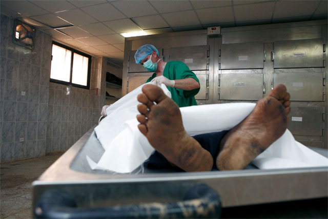 Собрался поставить импланты Собрался поставить импланты