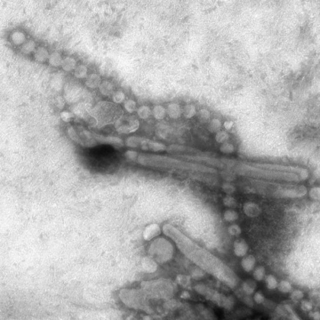 В скором времени в лаборатории, возможно, создадут самый опасный штамм вируса гриппа H7N9 (фото Cynthia S. Goldsmith/Thomas Rowe/СDC). 