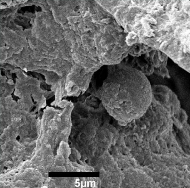 Электронная микрофотография фитолитов чесночницы. Масштабная линейка — 5 микрометров (фото H. Saul et al.) 