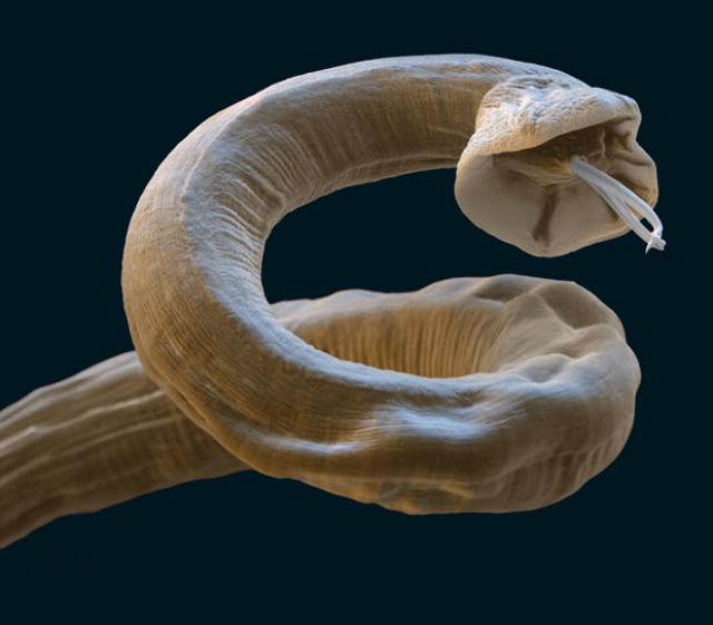 Паразит Angiostrongylus vasorum, смертельно опасный для собак, "путешествует" вместе с улитками(иллюстрация Bayer Animal Health/PA).