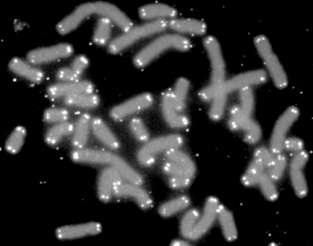 Теломеры являются концевыми участками хромосом и выполняют защитную функцию. Обозначены белым цветом (фото Wikimedia Commons). 