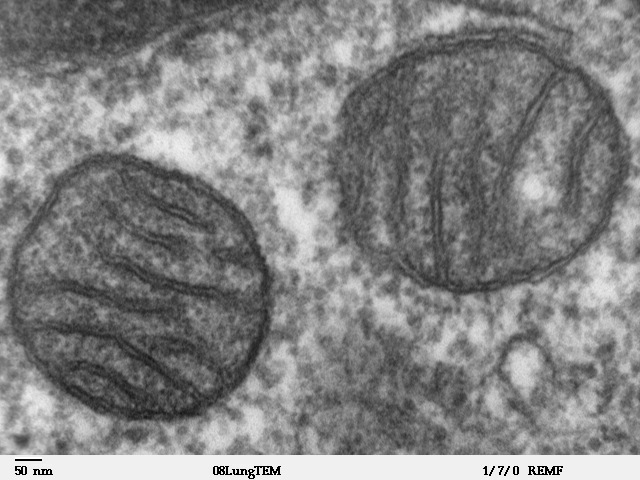 Фотография электронного микроскопа, показывающая митохондрии человека в поперечном сечении. Митохондрии могут содержать неисправные ДНК (фото Louisa Howard/Wikimedia commons).