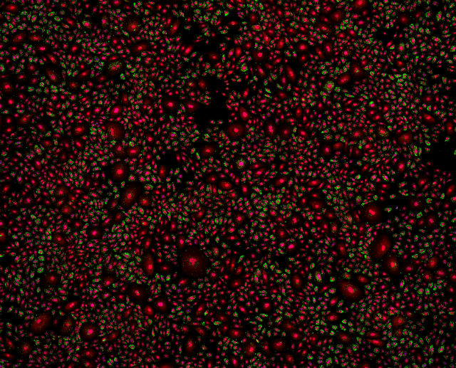 Транскрипты MKI67 в кератиноцитах, клетках эпиермиса, человека (фото Pelkmans Lab). 