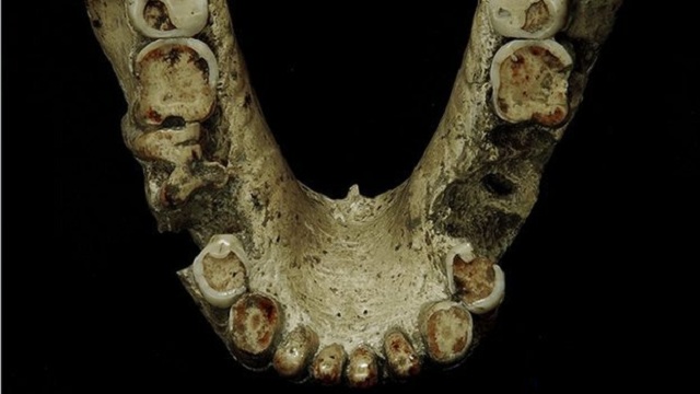 У одной из особей зубы выпали ещё при жизни, "георгиец" явно не мог поедать твёрдую пищу (фото Georgian National Museum).