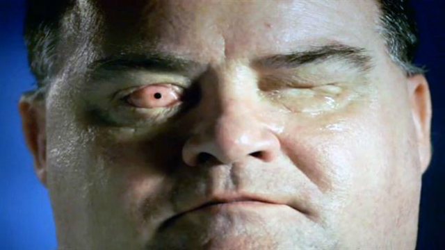 Ян Тиббетс после радикальной глазной хирургии (фото с сайта video.perthnow.com.au).