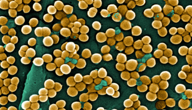 Инфекцию золотистого стафилококка можно обнаружить на ранних стадиях развития (фото Janice Haney Carr, Centers for Disease Control and Prevention). 