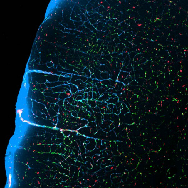 Когда мыши спят, заполненные жидкостью каналы (бледно-голубые) между нейронами расширяются и вымывают токсины (фото Maiken Nedergaard/Jeff Iliff).