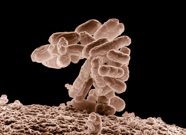 В качестве "подопытного кролика" исследователи выбрали бактерию кишечной палочки (фото Eric Erbe/Wikimedia Commons). 
