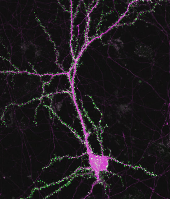 Клетка мозга. Зелёным цветом обозначены синапсы, а розовым — сам нейрон (фото Yoichi Araki). 