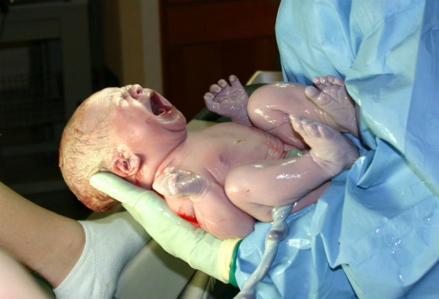 Исследователи из детского медицинского центра Цинцинати (США) обнаружили систему естественного подавления иммунитета у новорождённых, которая позволяет полезным микробам заселять кишечник, кожу, ротовую полость и лёгкие ребёнка (фото Wikimedia Commons).