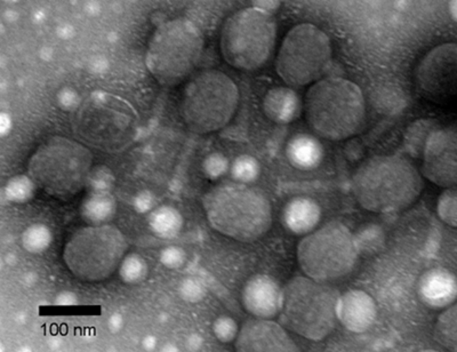 Тёмные круглые капли на этой микрофотографии – капсиды бактериофага Т4, которые сохраняют свою характерную форму после того, как покрываются диоксидом кремния. Длинные прямые "хвосты" множества вирусных частиц можно увидеть отходящими от некоторых капсидов (фото Jim Laidler). 