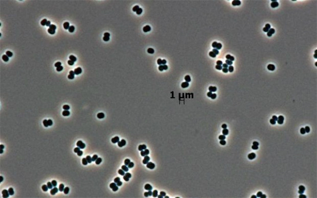 Этот вид бактерий, получивший название Tersicoccus phoenicis, был обнаружен в двух чистейших комнатах, предназначенных для создания космических аппаратов (иллюстрация NASA/JPL-Caltech). 