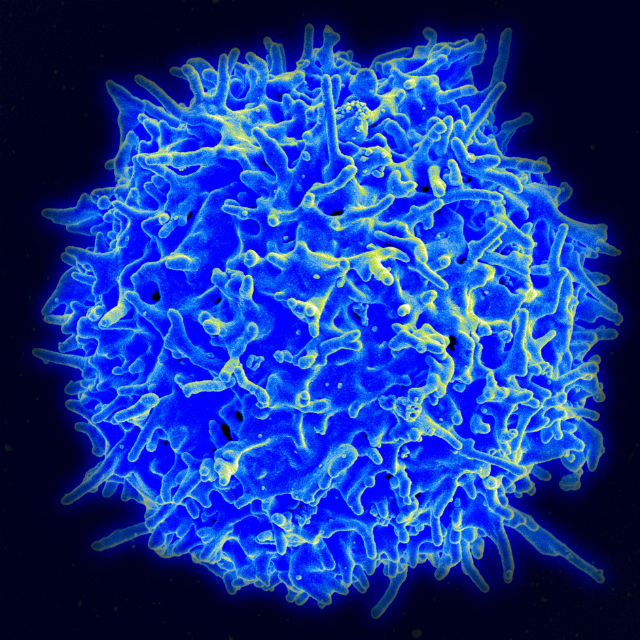 Электронная микрофотография иммунной Т-клетки (фото Wikimedia Commons). 