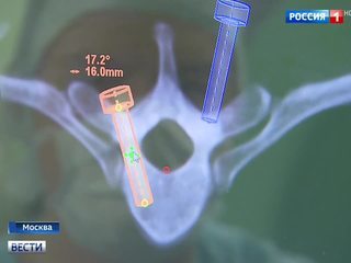 Московские нейрохирурги провели мастер-класс в режиме онлайн